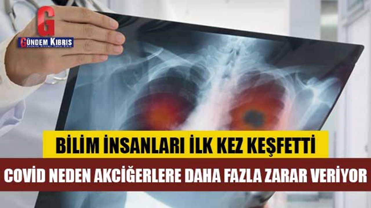 Covid-19, neden akciğerlere diğer zatürre türlerinden daha fazla zarar veriyor?