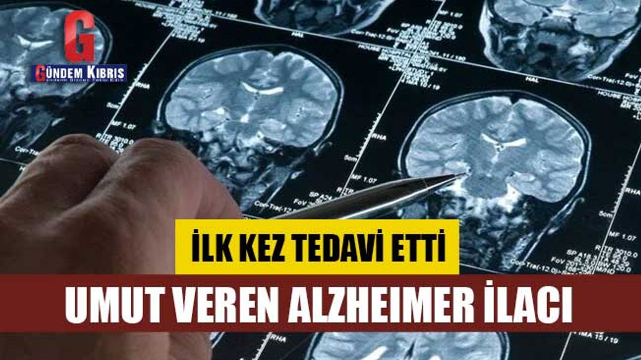 Alzheimer hastaları için gerçek bir tedavi sunan ilk ilaç