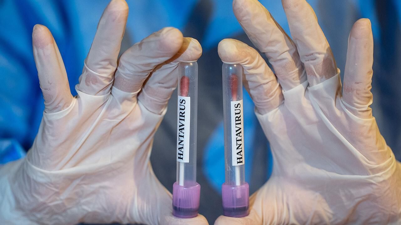 Güney Kıbrıs’ta Hantavirüsüyle ilgili hazırlık planı