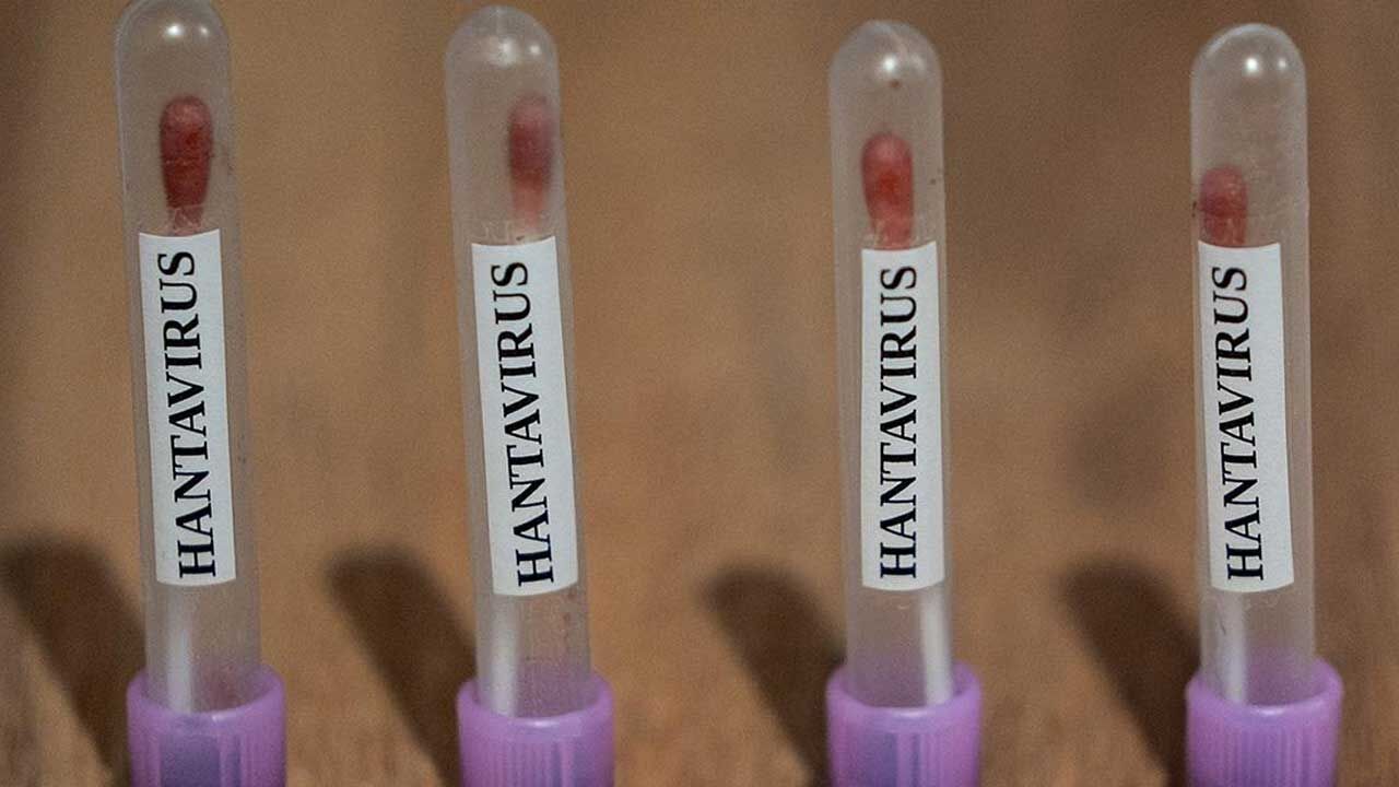 DSÖ: Hantavirüsün küresel nüfus için oluşturduğu risk düşük