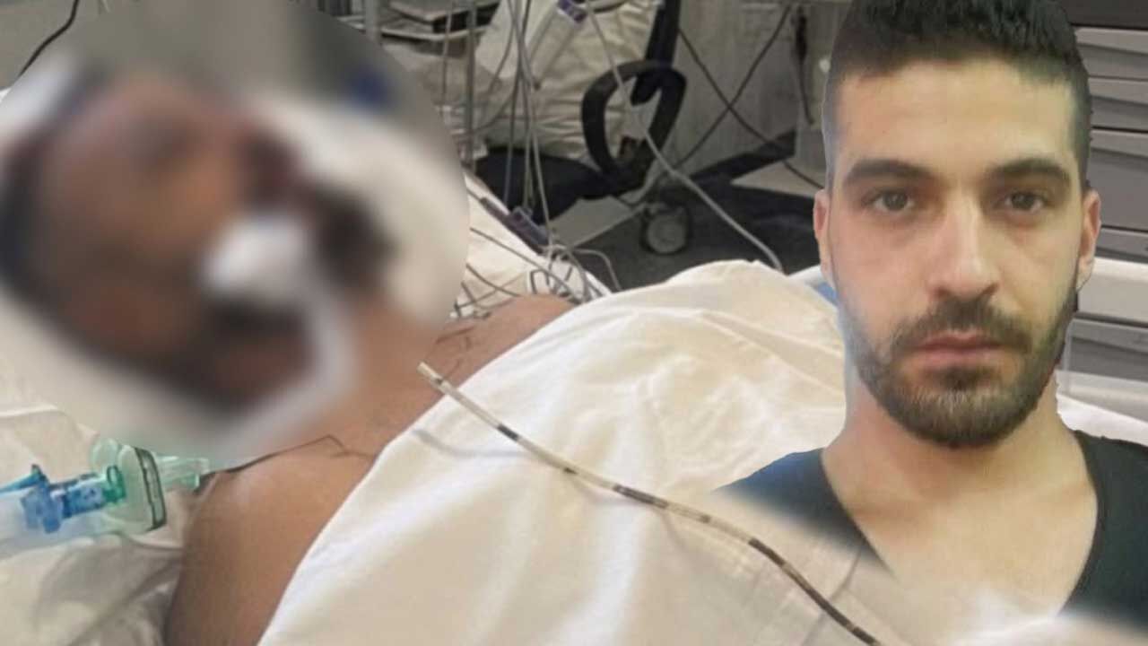 Burak Anıldı: Aya Napa saldırısı, 2015'te yaşadığımız ırkçı saldırıyı hatırlattı