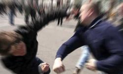 Yer Kıbrıs : Kızgın baba otizmli çocuğa saldırdı