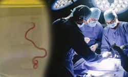 Unutkanlık ve depresyon şikayetiyle hastaneye gitti! Beyninden canlı solucan çıktı