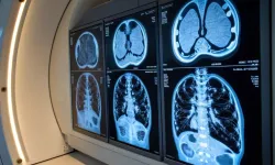 Araştırma: Alzheimer riskinin ilk işareti beyne giden kan akışındaki sessiz düşüş olabilir