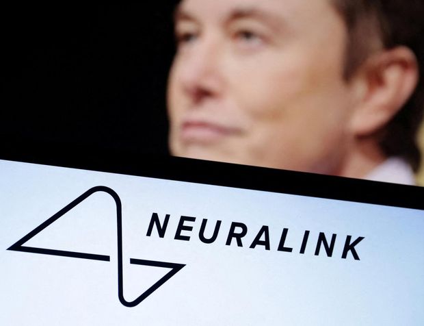 Musk, beyin çipi deneyinin ilk sonucunu duyurdu: Fare imlecini oynatabildi