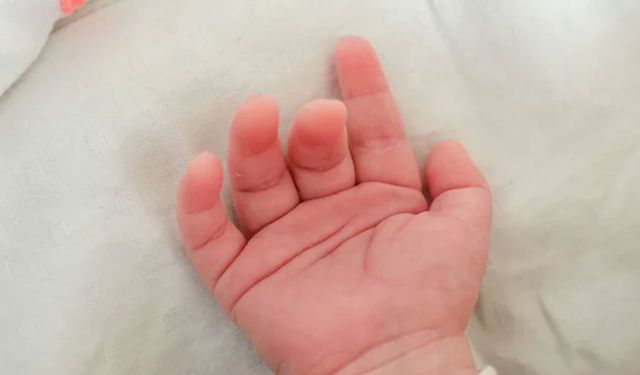 20 aylık bebekten üzen haber