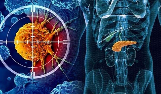 Pankreas kanserinde "olağanüstü aşı" keşfedildi: Ömrü uzatıyor