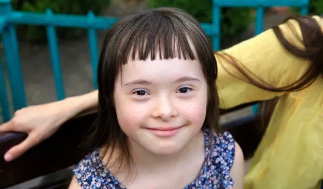 KTTB: Down sendromu bir hastalık değil, genetik bir farklılık