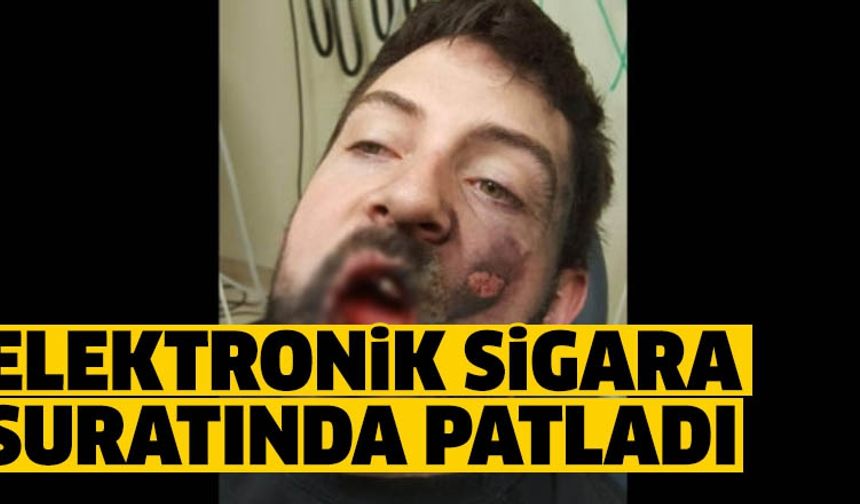 Elektronik sigara patladı!